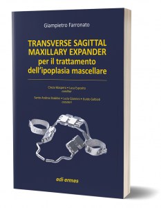 Transverse Sagittal Maxillary Expander per il trattamento dell'ipoplasia mascellare